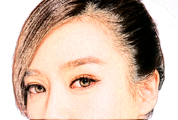 六安市人民醫(yī)院植發(fā)技術怎么樣【植發(fā)案例】