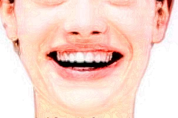 2024北京大學(xué)第一醫(yī)院補(bǔ)牙做的好嗎_哪位醫(yī)生做的比較好