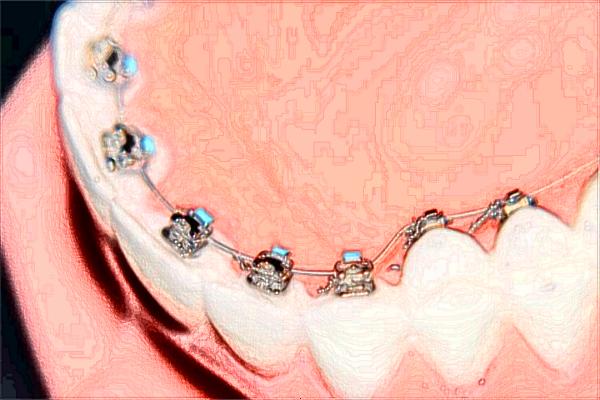 北京大學第一醫(yī)院口腔科那個醫(yī)生好+案例分享