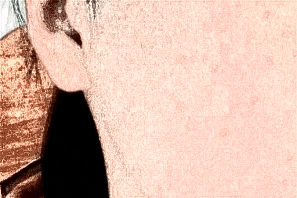 2024南昌大學(xué)第二附屬醫(yī)院祛斑多少錢(qián)?祛斑后多久恢復(fù)正常