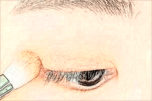 九江學院附屬醫(yī)院割雙眼皮咋樣?割雙眼皮有沒有風險