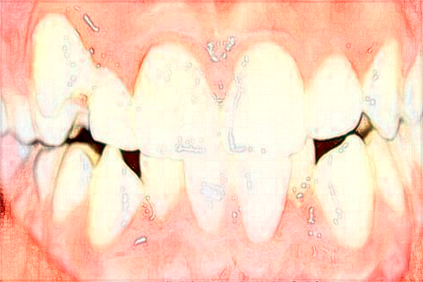 吉安市中心人民醫(yī)院口腔科種植牙口碑_收費(fèi)價(jià)格