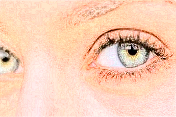 2024無錫市第二人民醫(yī)院激光矯正靠譜嗎_哪位醫(yī)生技術(shù)比較好