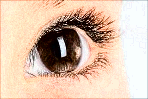 2024無錫市第二人民醫(yī)院激光矯正靠譜嗎_哪位醫(yī)生技術(shù)比較好