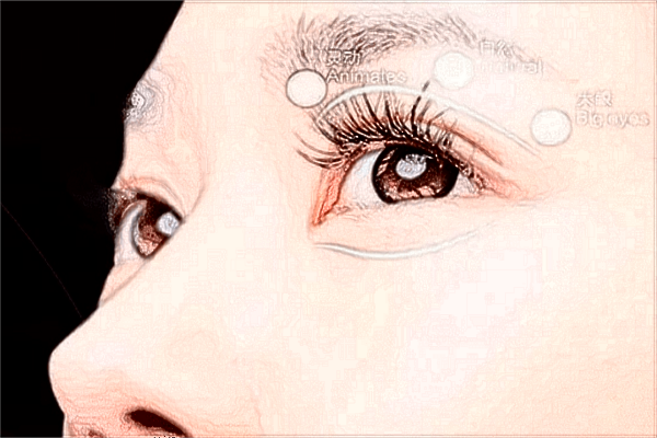 贛州市人民醫(yī)院去眼袋好嗎?2024去眼袋手術(shù)多少錢(qián)