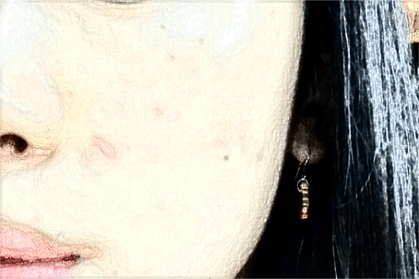 2024贛州市人民醫(yī)院祛斑多少錢(qián)?激光祛斑怎么樣