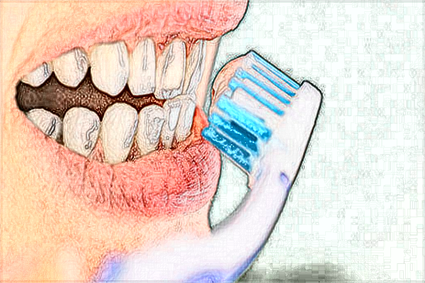 2024山東大學口腔醫(yī)院牙齒貼片價格?牙齒貼片的缺點危害