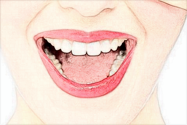 2024四川大學華西口腔醫(yī)院種植牙價格多少?種植牙案例分享