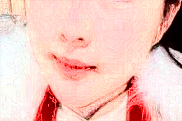 2024大連醫(yī)科大學附屬第一醫(yī)院祛痣價目表(價格表)怎么樣