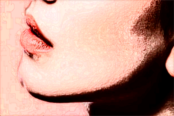 大連醫(yī)科大學附屬第一醫(yī)院激光去紅血絲做的好嗎_案例價格分享