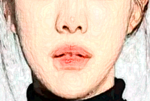 保定市第一中心醫(yī)院激光祛斑價(jià)目表(價(jià)格表)怎么樣