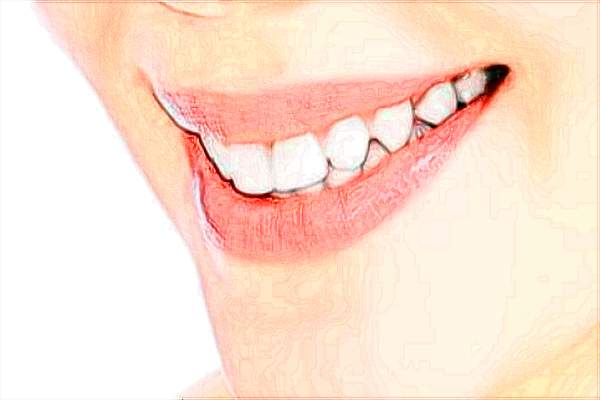 南充市中心醫(yī)院種植牙做的好嗎_案例價格分享