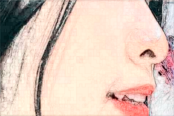 2024常州市第一人民醫(yī)院激光去色素沉重做的好嗎【案例分享】