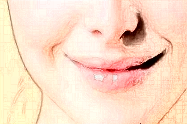 常州市第一人民醫(yī)院激光脫毛需要多少錢_激光脫毛案例分享