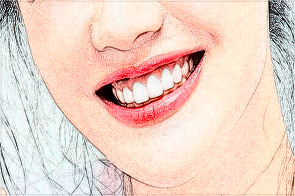 2024重慶醫(yī)科大學(xué)附屬口腔醫(yī)院全口義齒怎么樣_案例+價(jià)格