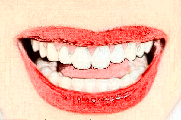 重慶醫(yī)科大學(xué)附屬口腔醫(yī)院是三甲醫(yī)院嗎？收費標(biāo)準(zhǔn)