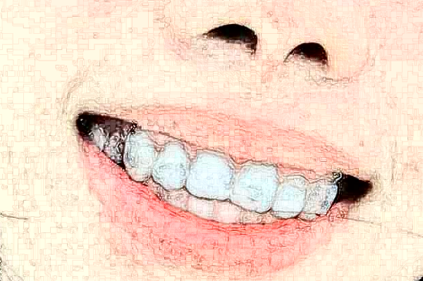 常州市第一人民醫(yī)院口腔科顧敏醫(yī)生技術(shù)怎么樣_擅長(zhǎng)什么