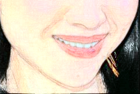 重慶醫(yī)科大學(xué)附屬口腔醫(yī)院做牙齒矯正價(jià)目表(價(jià)格表)怎么樣