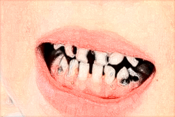 江西省口腔醫(yī)院種植牙哪個(gè)醫(yī)生好?2024種植牙醫(yī)生收費(fèi)
