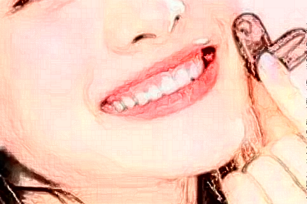 2024四川大學(xué)華西口腔醫(yī)院齙牙矯正怎么樣_哪個(gè)醫(yī)生做的不錯(cuò)