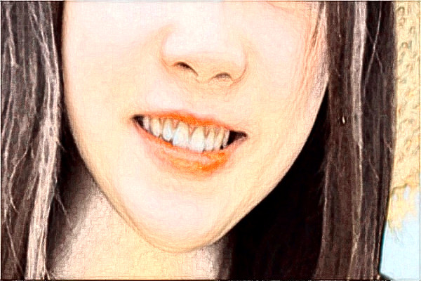 蘇州大學(xué)附屬第二醫(yī)院牙齒根管怎么樣_醫(yī)生技術(shù)好不好