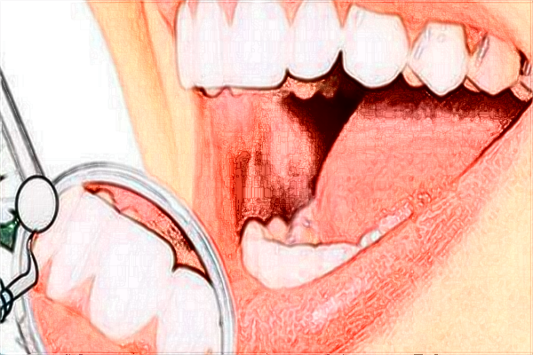 2024南昌大學第一附屬醫(yī)院拔牙多少錢?拔牙掛什么科