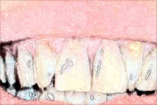 2024南昌大學(xué)第一附屬醫(yī)院牙齒矯正價(jià)格?牙科比較好的醫(yī)師