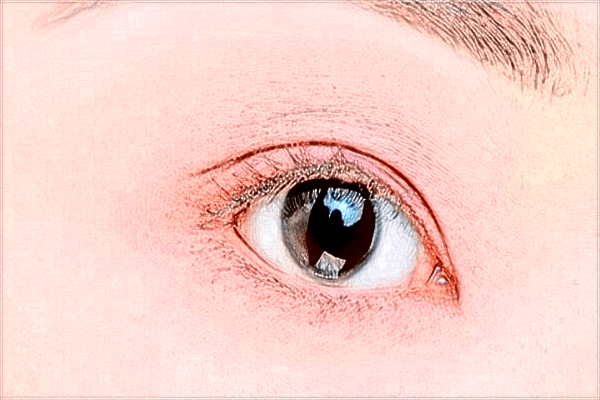 南昌大學(xué)第一附屬醫(yī)院近視激光手術(shù)怎么樣?近視激光手術(shù)價格