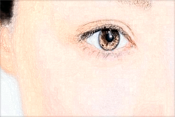 南昌大學(xué)第一附屬醫(yī)院近視眼手術(shù)好嗎?2024近視眼手術(shù)費(fèi)用