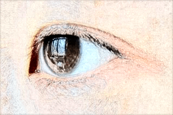 南昌大學(xué)第一附屬醫(yī)院近視眼手術(shù)好嗎?2024近視眼手術(shù)費(fèi)用