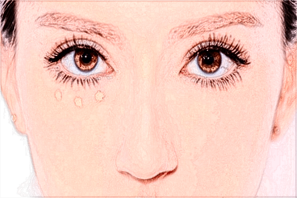 南昌大學(xué)第一附屬醫(yī)院熱瑪吉怎么樣?熱瑪吉和熱拉提區(qū)別