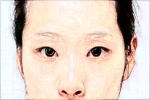 2024臺(tái)州醫(yī)院光子嫩膚做的好嗎_誰做的比較好