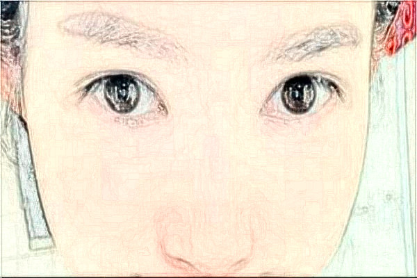 金華市中心醫(yī)院半飛秒做的好嗎_案例+價格