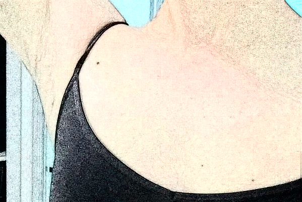 金華市中心醫(yī)院可以做祛腋臭嗎_做的怎么樣