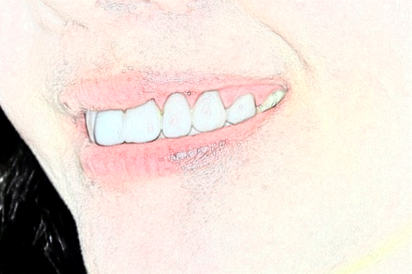 蘇州大學附屬第二醫(yī)院全瓷牙做的怎么樣_哪個醫(yī)生做的比較好