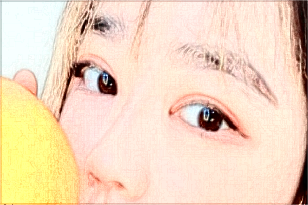 哈爾濱醫(yī)科大學附屬第一醫(yī)院近視手術(shù)做的好嗎_案例+價格