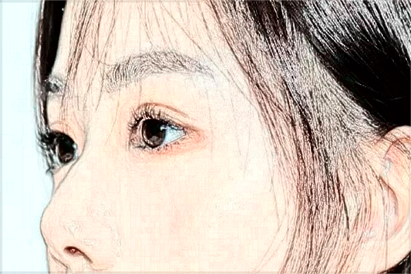 阜陽(yáng)市人民醫(yī)院祛雀斑做的怎么樣_哪位醫(yī)生比較好