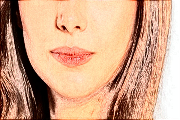 四川大學(xué)華西口腔醫(yī)院祛痣好不好_案例+價格