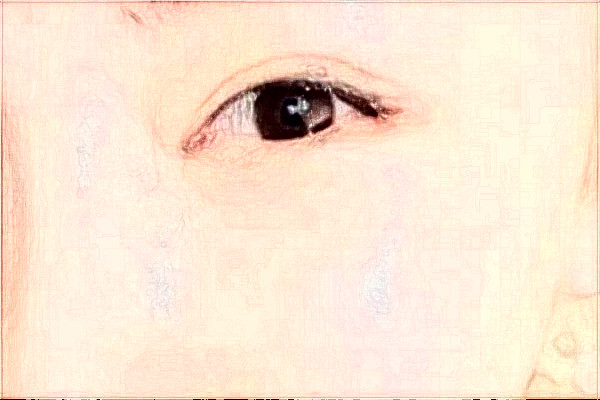 2024哈爾濱醫(yī)科大學(xué)附屬第一醫(yī)院半飛秒怎么樣_需要多少錢