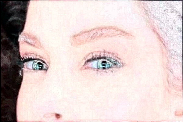 2024金華市中心醫(yī)院全飛秒做的咋樣_案例分享