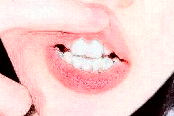 2024徐州市中心醫(yī)院種植牙做的好嗎_誰做的比較好