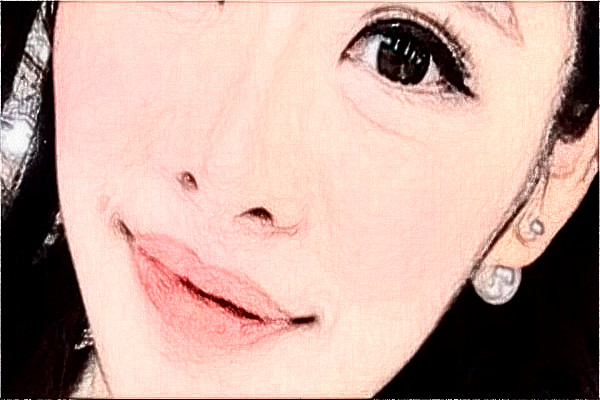 阜陽(yáng)市人民醫(yī)院祛胎記做的好嗎_案例+價(jià)格