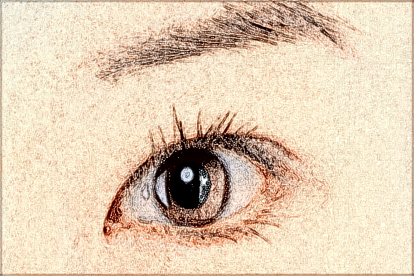 2024中山市人民醫(yī)院激光近視手術(shù)價(jià)格?激光近視手術(shù)原理