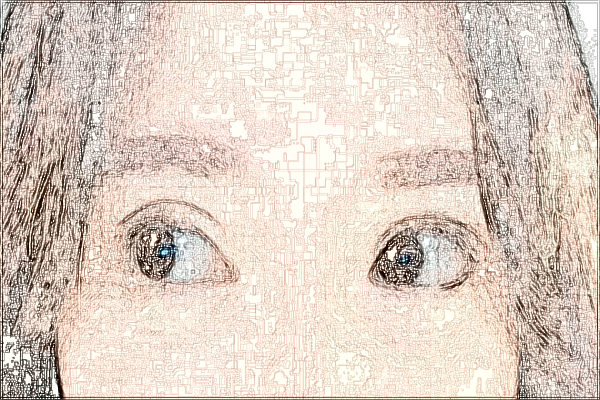 2024中山市人民醫(yī)院飛秒手術(shù)價(jià)格?飛秒手術(shù)有風(fēng)險(xiǎn)嗎