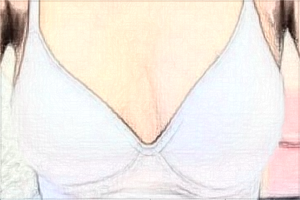 2024珠海市人民醫(yī)院玻尿酸豐胸價格?豐胸對身體有什么影響