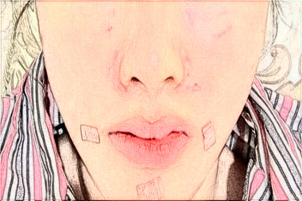 2024阜陽(yáng)市人民醫(yī)院整形美容外科怎么樣？2024醫(yī)生介紹