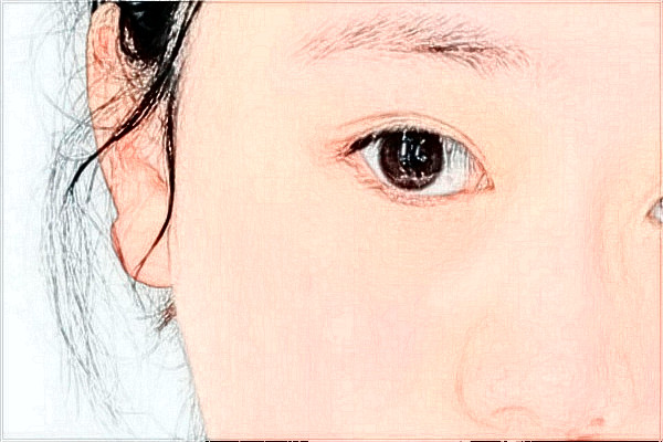 2024臺州醫(yī)院飛秒做的好嗎_誰做的比較好