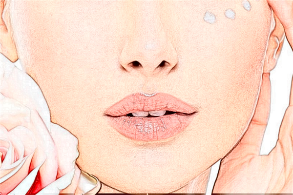 2024泉州180醫(yī)院激光祛痘印價(jià)格?激光祛痘印一次能去掉嗎?