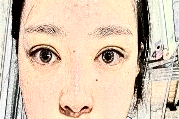 2024天津人民醫(yī)院激光祛斑怎么樣？案例價(jià)格一覽