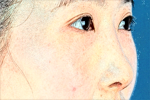 2024天津人民醫(yī)院激光祛斑怎么樣？案例價(jià)格一覽